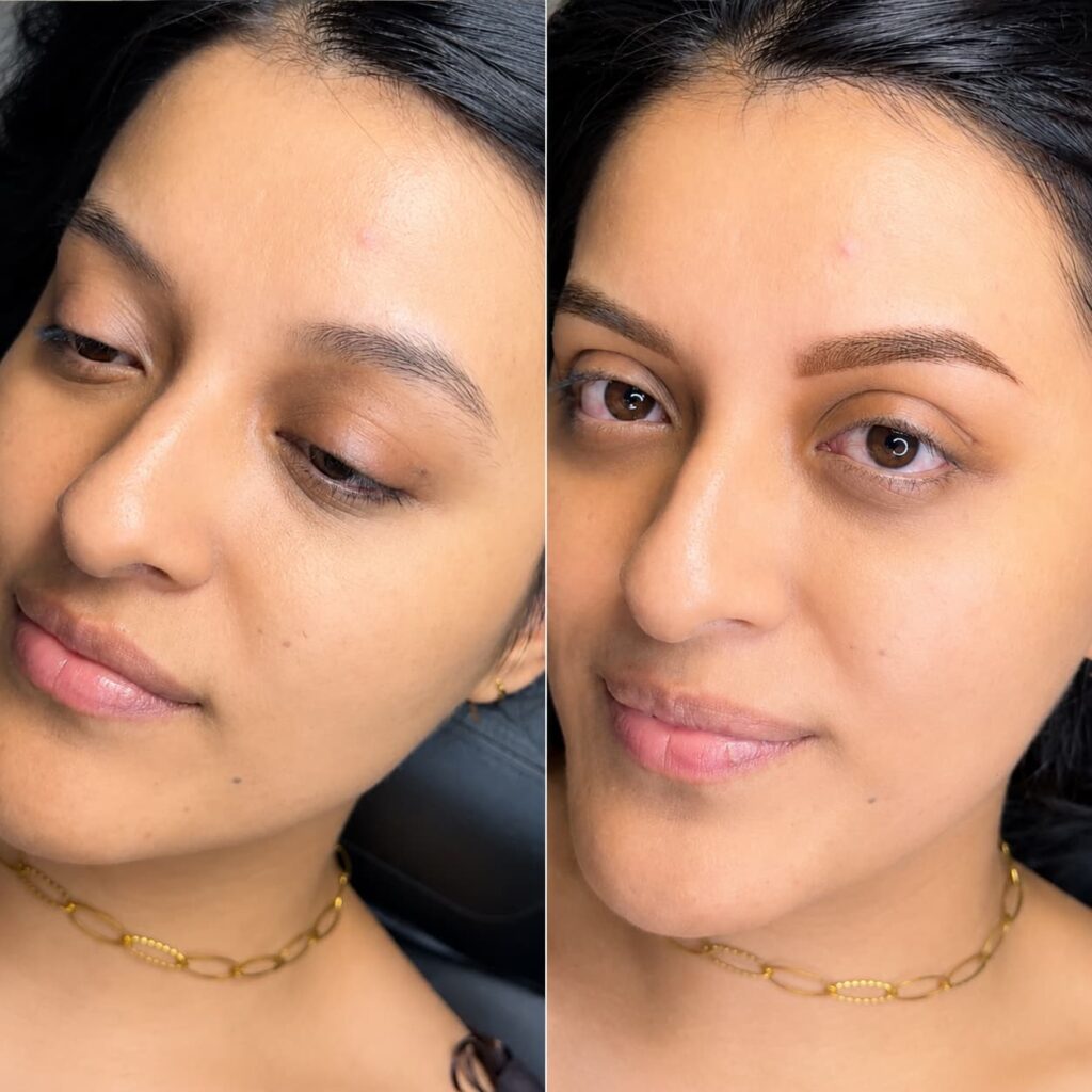 antes y despues sombreado
