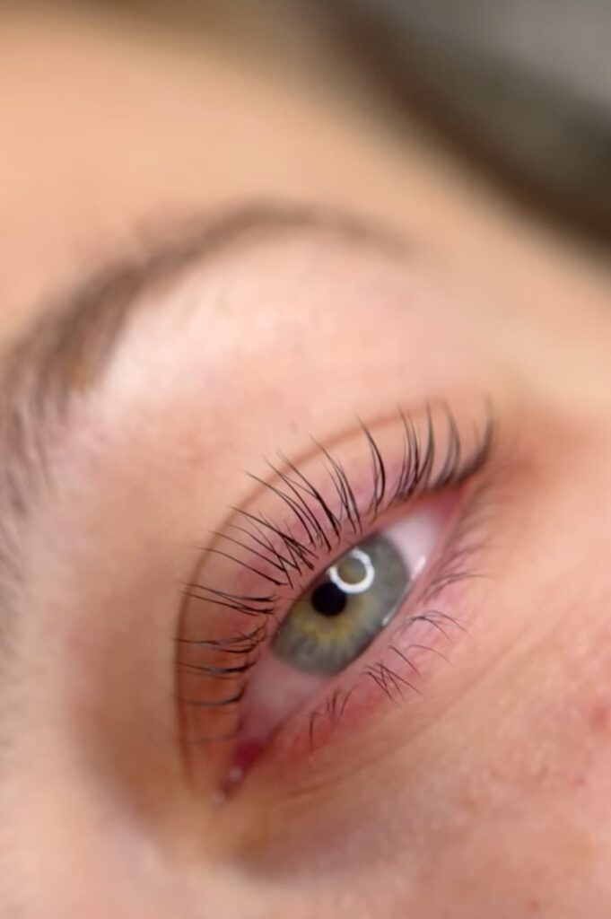 lifting un ojo