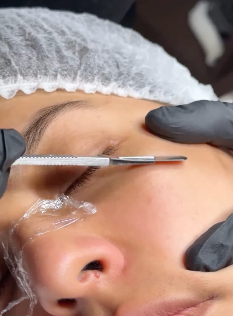 Tratamientos Faciales limpieza y renovación