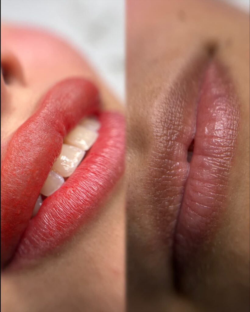 micro labios