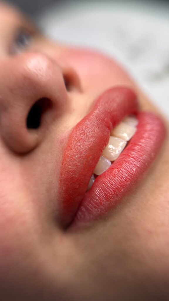 micro labios