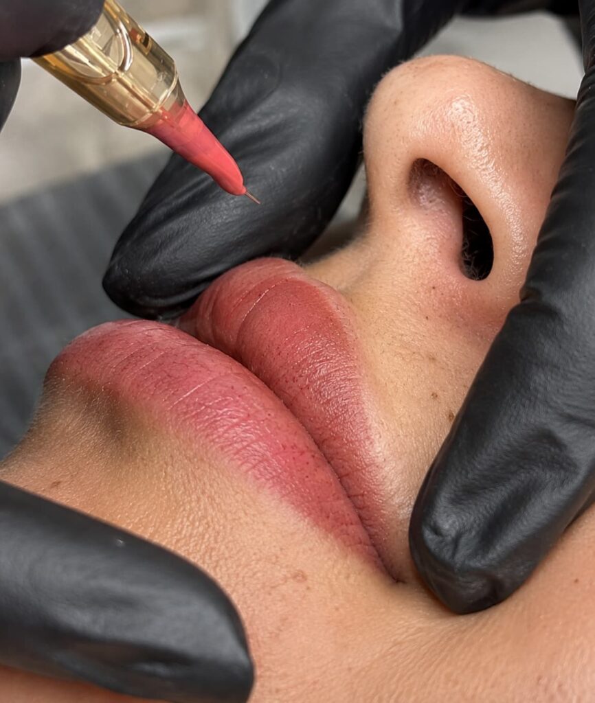 micro labios proceso