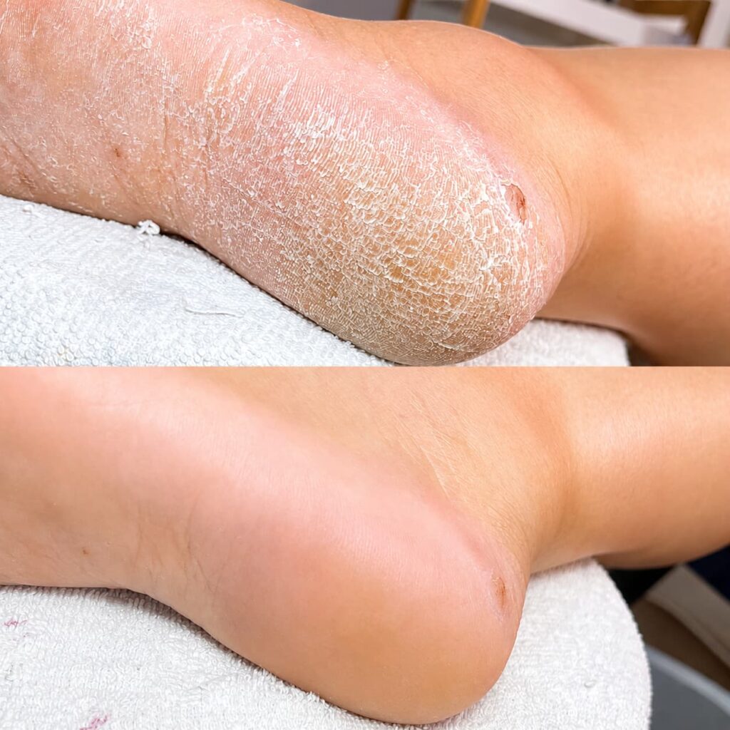 pedi antes y despues