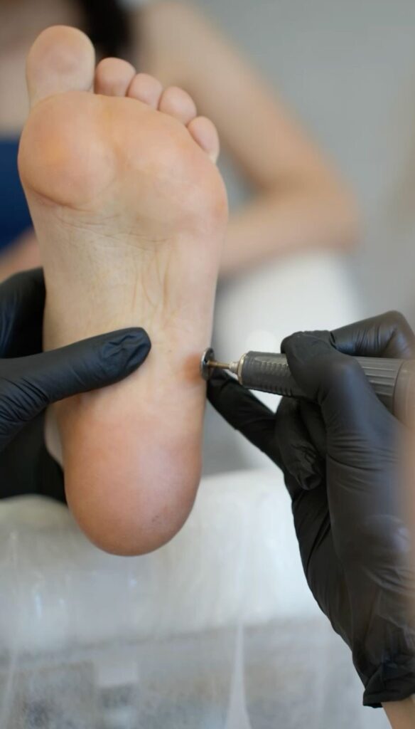 pedicura