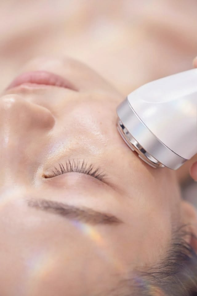 radiofrecuencia facial