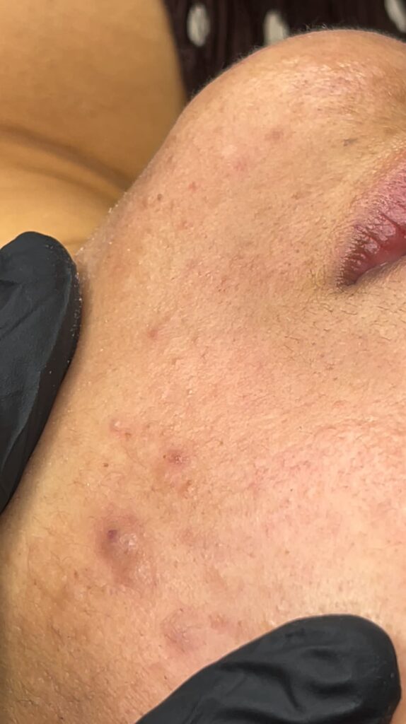 valoración piel rostro