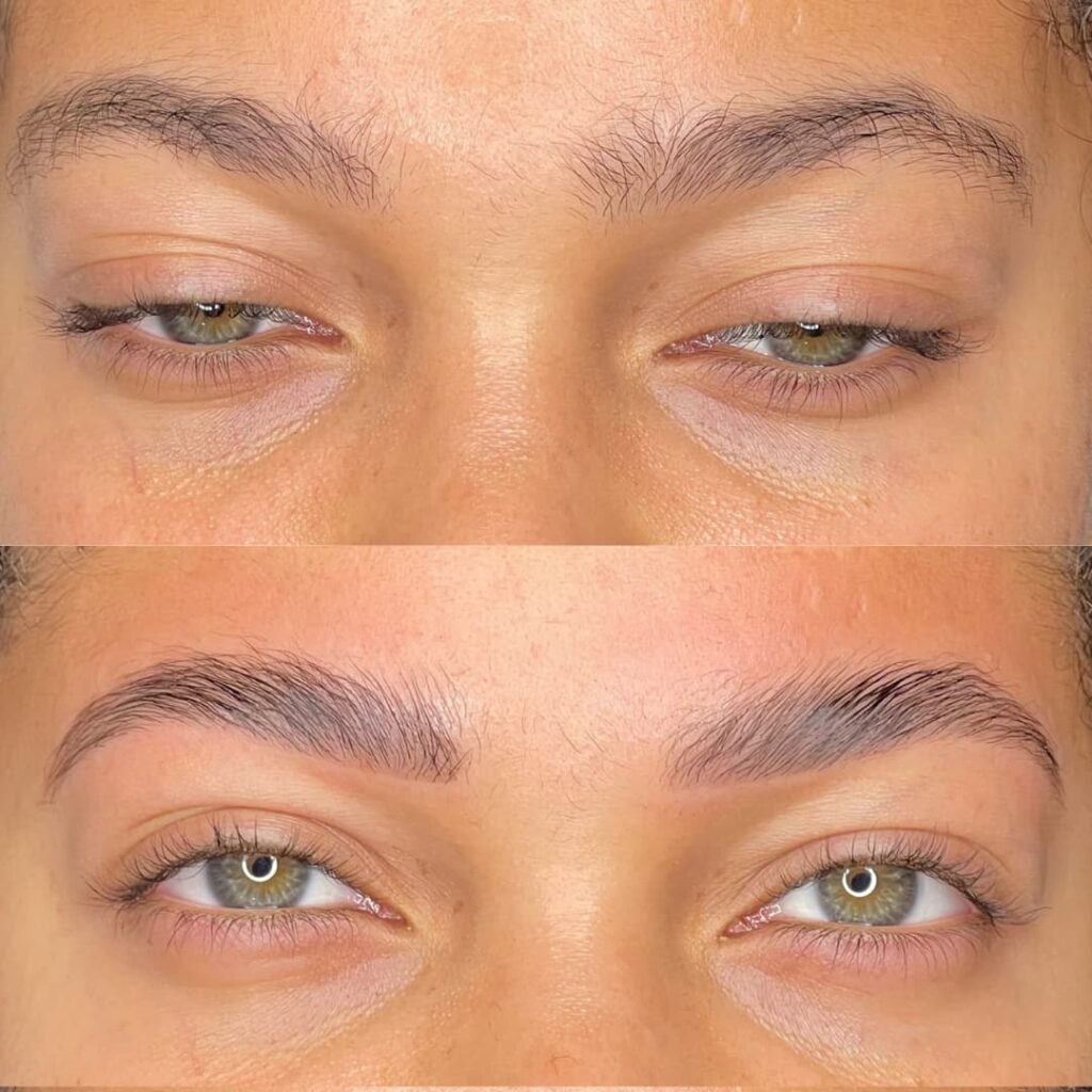 antes y despues cejas