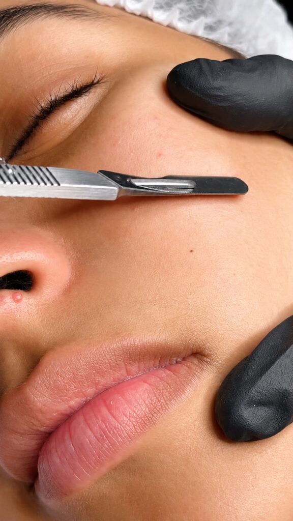 dermaplaning2 copia