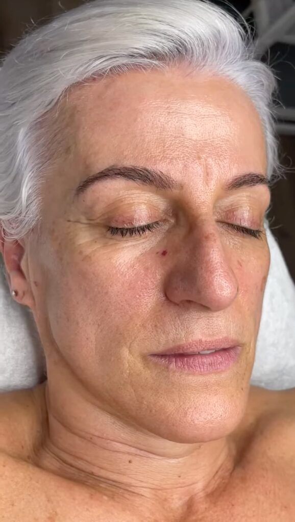 Tratamientos Faciales reafirmación y antiedad